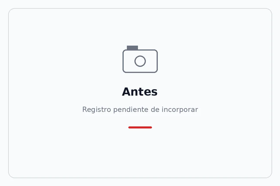 Antes: espacio para el registro del caso